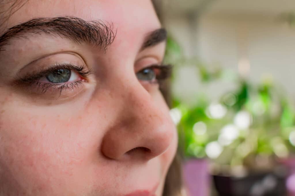 Allergie oculari e malattia dell’occhio secco: esiste un legame?